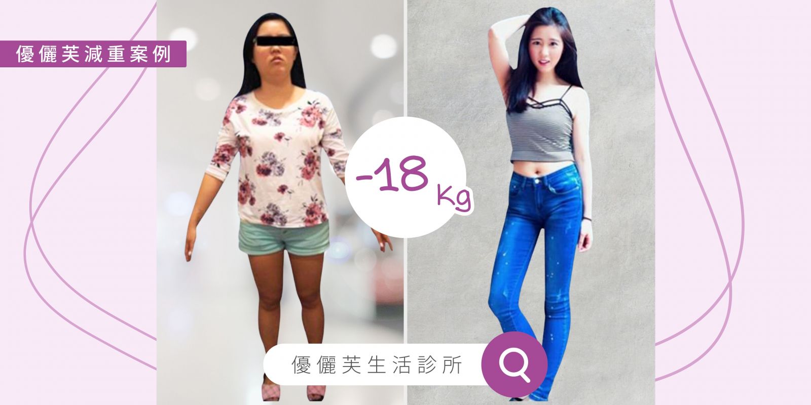 減肥門診-女生減肥-中醫減肥-台北-士林-天母
